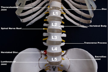 Lumbar Spine, Anterior View, Labelled 