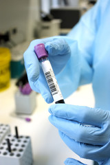 Hand with test tube of blood