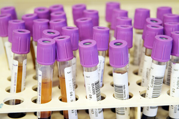 Rack with test tubes of blood