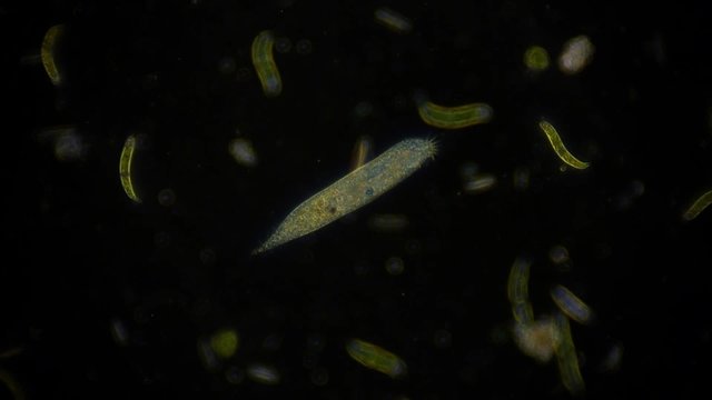Mikroorganismus unter dem Dunkelfeldmikroskop - 1080p Full HD