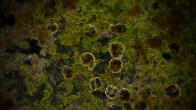 Mikroorganismen im Dunkelfeld - 1080p Full HD