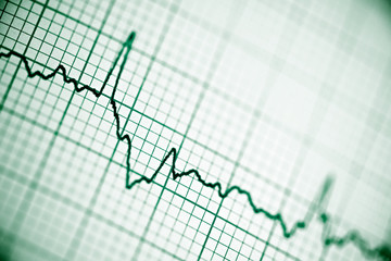 Electrocardiogram