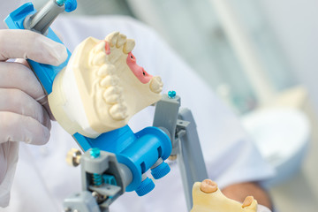 Dentist preparing a dental mould