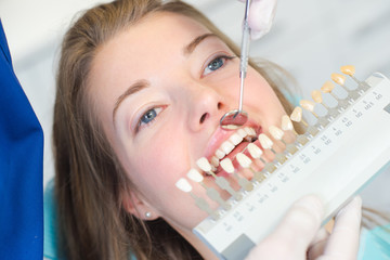 Finding the right shade for replacement tooth