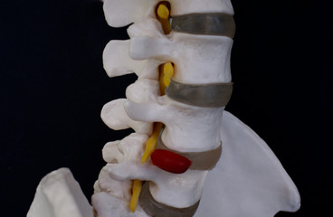 Lumbar Vertebrae 