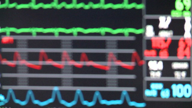 Vital signs (deliberately out of focus)