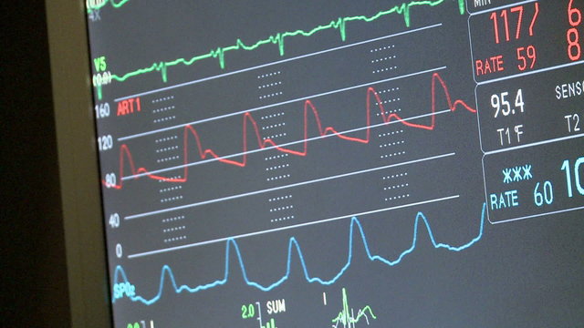 Monitor with vital signs