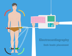 Electrocardiography vector concept. ECG limb leads flat illustration