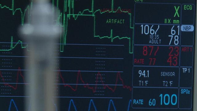 IV drip with vitals monitor in background during spinal surgery