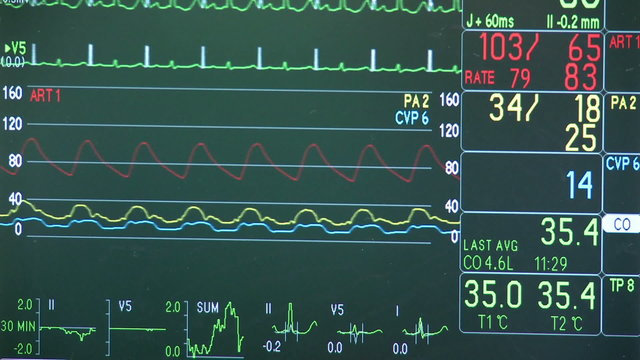 Vital signs monitor during surgery