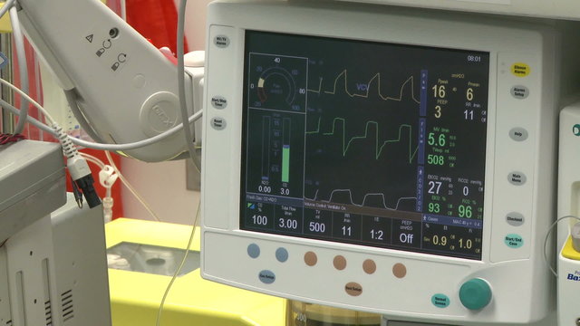 Vitals monitor with cell-saver machine in background