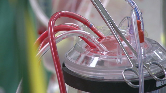 Blood flows through tubes of bypass machine