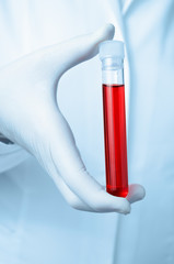 Hand with blood sample