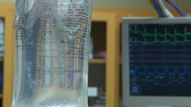 IV drip bag with vitals monitor in background during spinal surgery