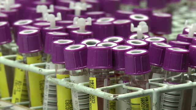 Blood samples (zoom out)