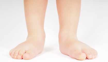 Little person standing up barefoot towards bright background