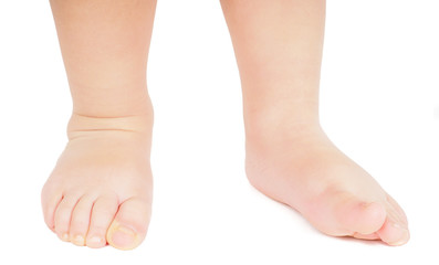 Little person walking towards barefoot isolated on white backgro