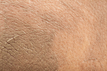 Closeup female face with clay mud facial mask