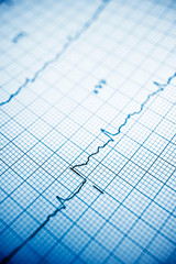 Naklejka premium Electrocardiogram
