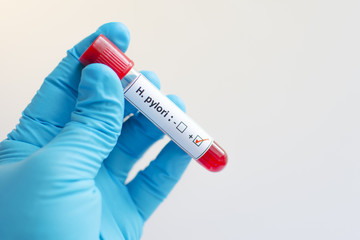Fototapeta premium H. pylori blood sample