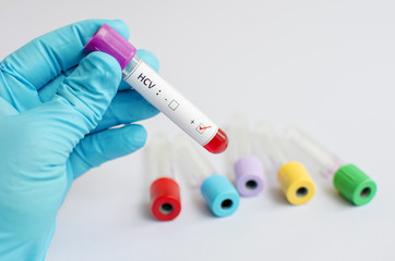 Fototapeta premium Hepatitis C virus (HCV)