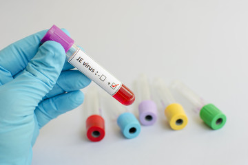 Blood sample with Japanese encephalitis virus (JE virus)