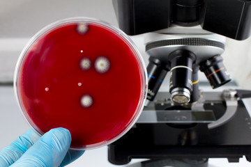 Laboratory technician holding petri dish with growth of fungi in lab / hand with an inoculating...