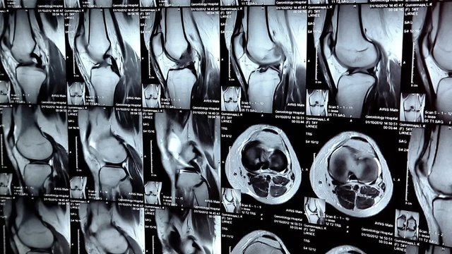 X-ray pictures in physicians office