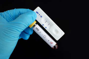 Obraz premium HIV testing positive