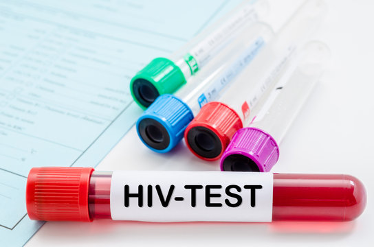Blood sample for HIV test.