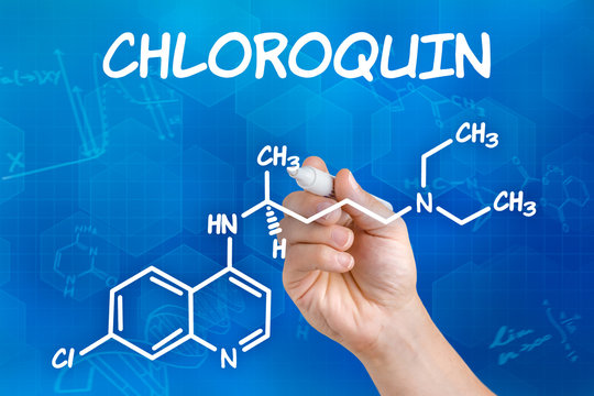Hand mit Stift zeichnet chemische Strukturformel von Chloroquin