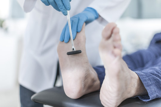 Doctor tapping patient with reflex hammer