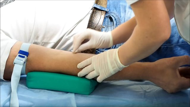 Доктор ставит капельницу. Подготовка места введения катетера