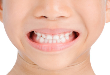 Obraz premium Smile teeth from kid
