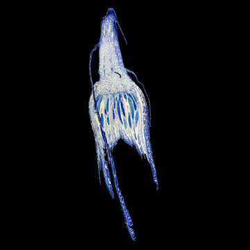 Moss protonemata micrograph