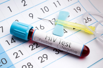 Blood test for analysis of HIV /blood sample in a tube with label HIV on a monthly planner appointments © angellodeco