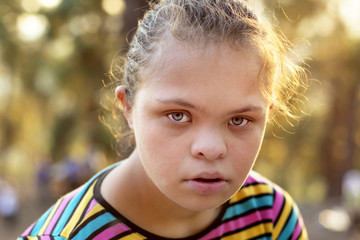 Down Syndrome Girl - Stock Image.