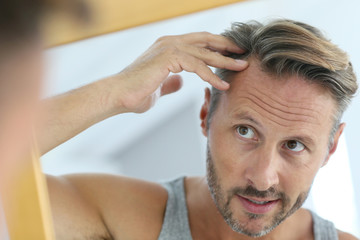 Middle-aged man concerned by hair loss - Powered by Adobe
