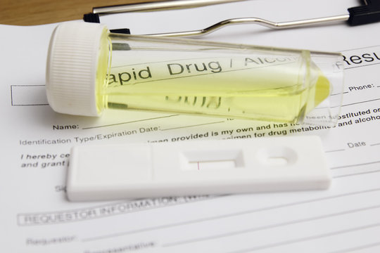 Drug Test Blank Form With Test Kit And Urine,focus On Paper