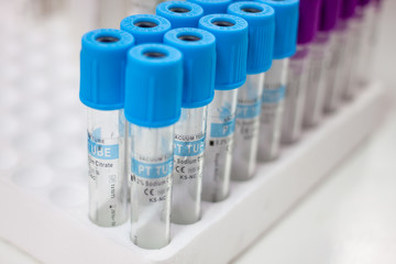 test tubes for testing