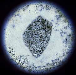 Bacterias in the shape of Swaziland viewed through a microscope.