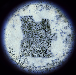 Bacterias in the shape of Angola viewed through a microscope.(se
