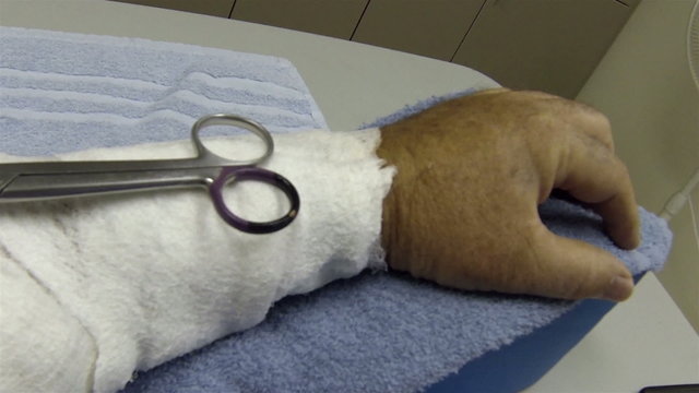 Medical surgery on bandaged arm scissors HD 006