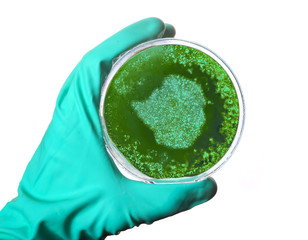 Germs in the shape of Zimbabwe in a petri dish.(series)