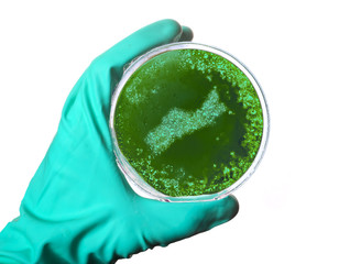 Germs in the shape of Nova Scotia in a petri dish.(series)