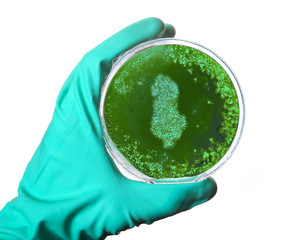 Germs in the shape of Albania in a petri dish.(series)