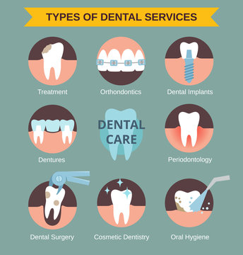 types of dental servises