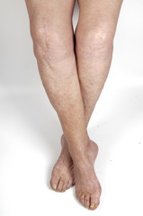 Senor  woman leg