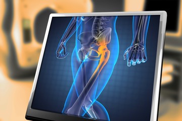 human radiography scan
