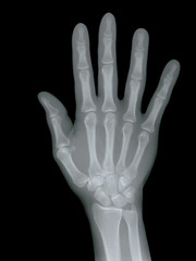 Radiography